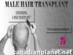 Get Quality Fue Hair Transplant, Islamabad