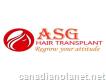 Asg Hair Transplant Centre