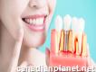Dental Implants in Kitchener Dentist in Kitchener