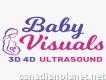 3d 4d baby visuals